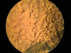 Phlebiodontia subochracea