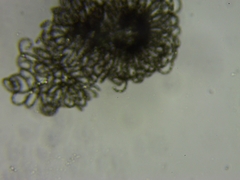 Dolichospermum lemmermannii