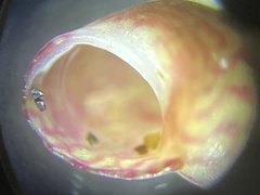 Eulithidium