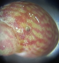 Eulithidium