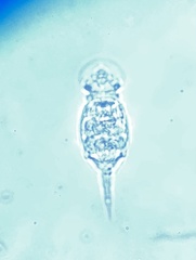 Squatinella