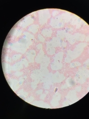 Enterobacteriaceae