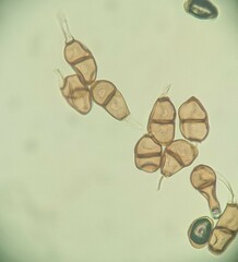 Puccinia angelicae