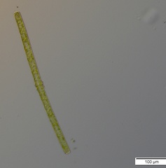 Pleurotaenium trabecula