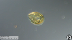 Arcella hemisphaerica