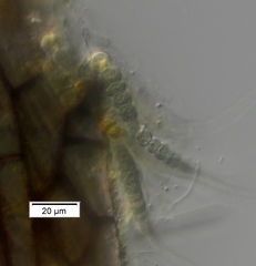 Calothrix