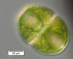 Cosmarium subspeciosum