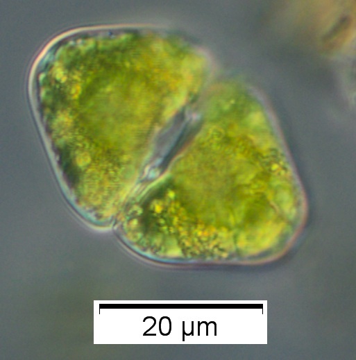Cosmarium granatum