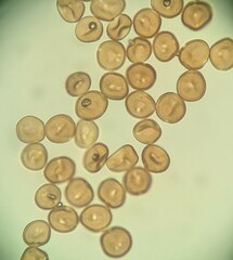 Puccinia calystegiae-soldanellae