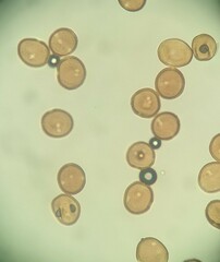 Puccinia calystegiae-soldanellae