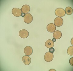 Puccinia calystegiae-soldanellae