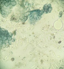 Leptosphaeria