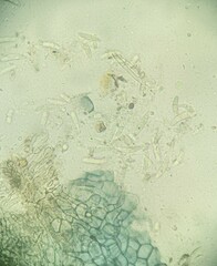 Leptosphaeria