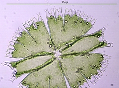 Micrasterias compereana