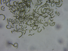 Dolichospermum lemmermannii