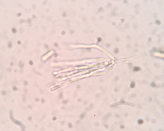 Paramyrothecium roridum