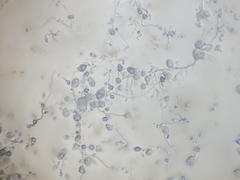 Aureobasidium namibiae