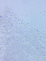 Marasmius minutissimus