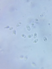 Marasmius minutissimus