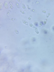 Marasmius minutissimus