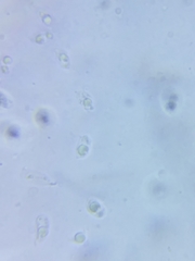 Marasmius minutissimus