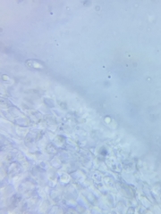 Marasmius minutissimus