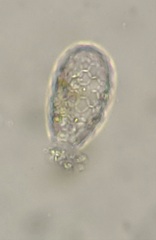 Euglypha tuberculata