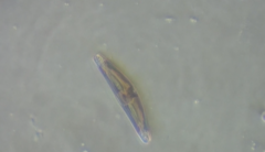 Cymbella
