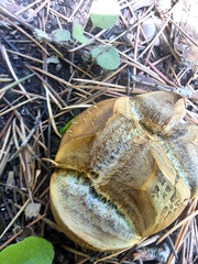 Scleroderma