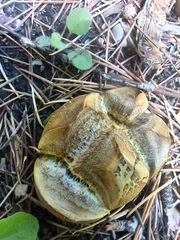 Scleroderma