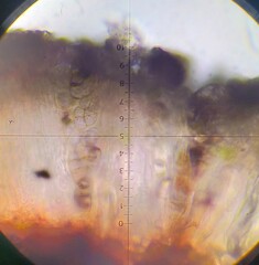 Rhizocarpon distinctum