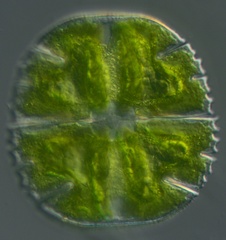 Micrasterias truncata