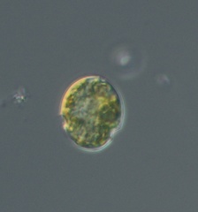 Parvodinium umbonatum