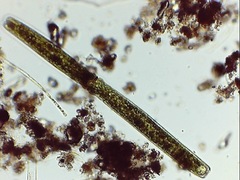 Pleurotaenium trabecula