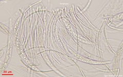 Strossmayeria basitricha