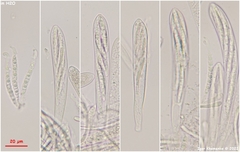 Strossmayeria basitricha