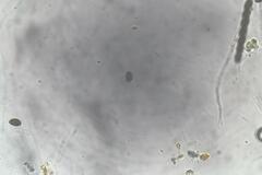 Hypoxylon crocopeplum