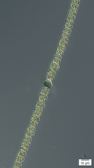 Anabaena