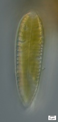 Surirella