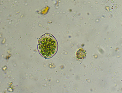 Nostocaceae