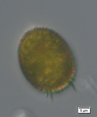 Trachelomonas armata