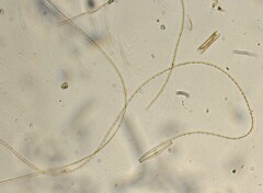 Oscillatoria redekei