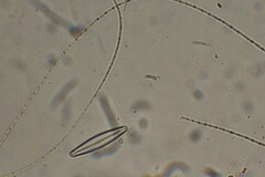 Oscillatoria redekei