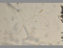 Oscillatoria redekei