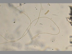 Oscillatoria redekei