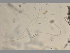 Oscillatoria redekei