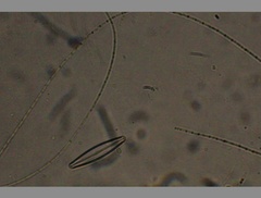 Oscillatoria redekei