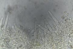 Inocybe australiensis