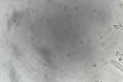 Inocybe australiensis