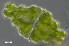 Euastrum humerosum affine